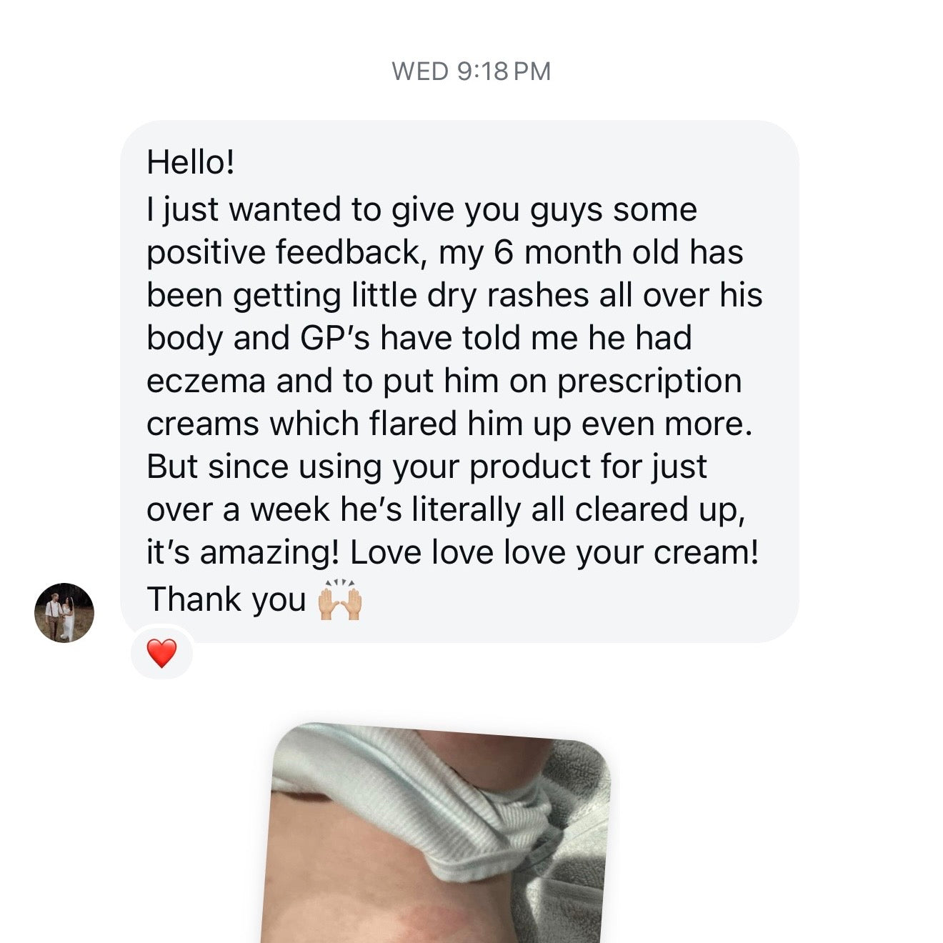 Skin Tallow Cream (Eczema & Psoriasis Safe)