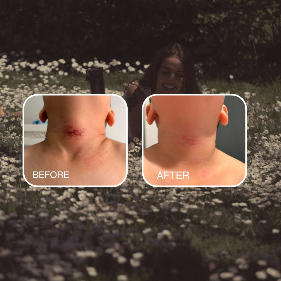 Skin Tallow Cream (Eczema & Psoriasis Safe)